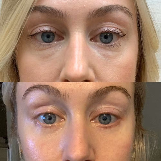 VT - PDRN Reedle Shot Eye Lifter