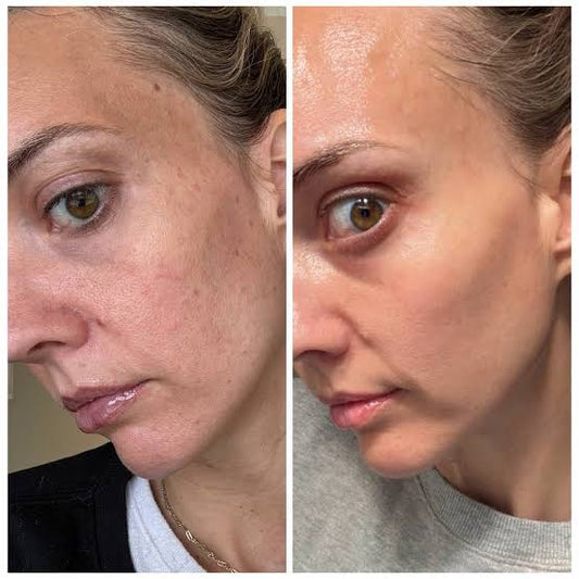 medicube - TXA Niacinamide Capsule Cream