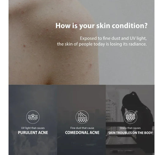 Anua - Heartleaf 77 Soothing Toner Mini