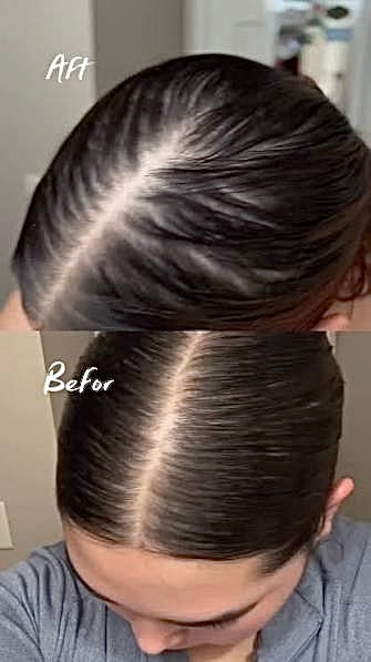 AROMATICA - Rosemary Scalp Scaling Shampoo