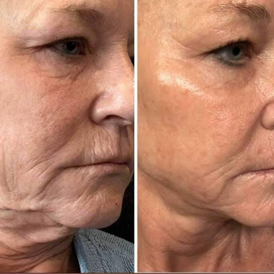 VT - PDRN Capsule Cream 100