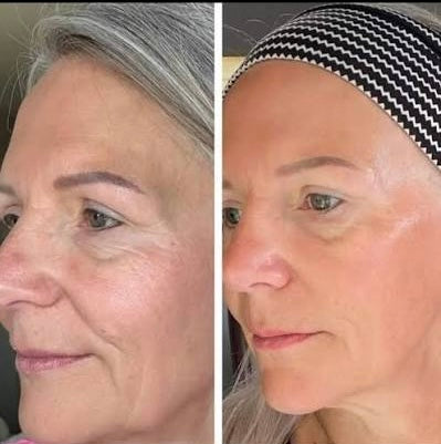 MEDIPEEL - Gold Age Tox H8 Cream