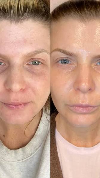 Medicube Triple Collagen Cream