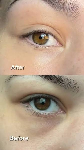 Arencia - Vitamin C Booster Shot