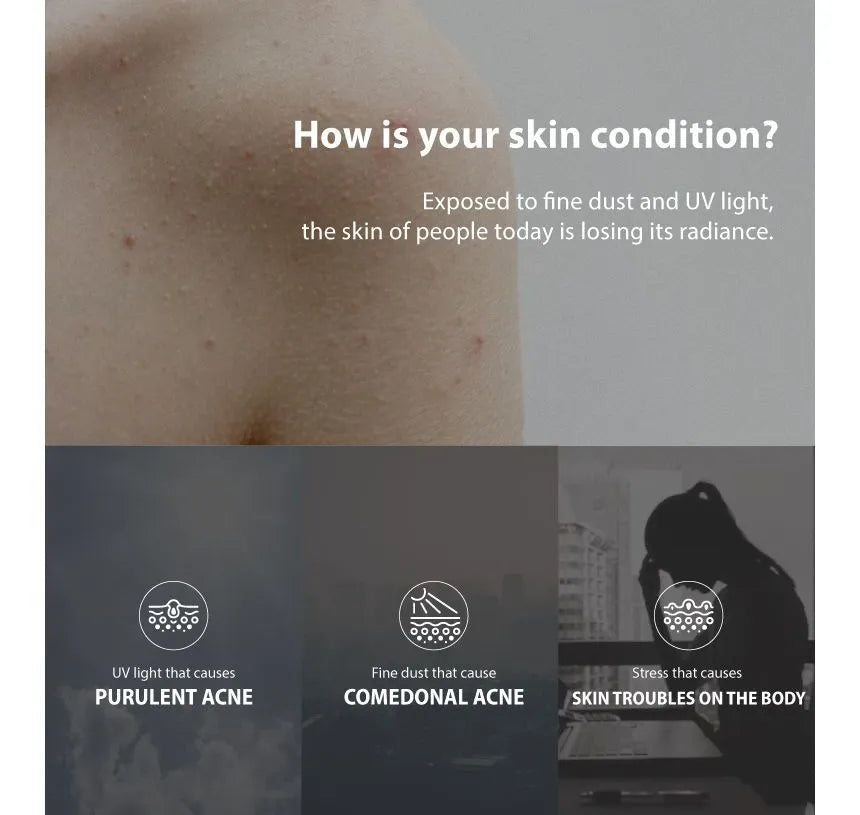 Anua - Heartleaf 77 Soothing Toner Mini