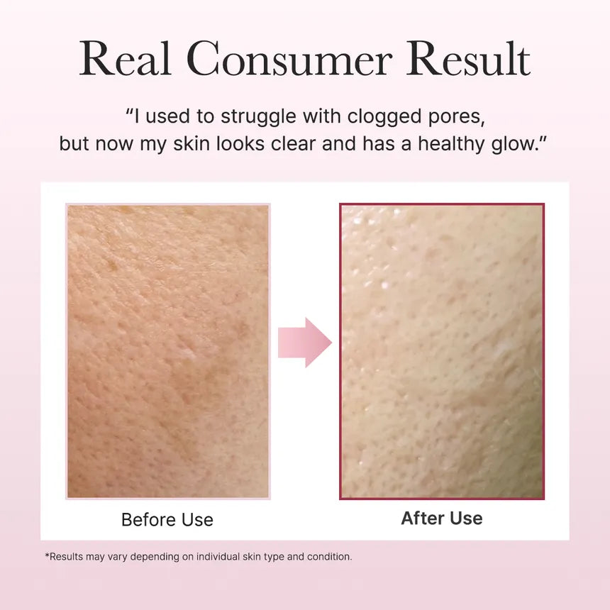 Arencia - Fresh Rosehip Rice Mochi Cleanser