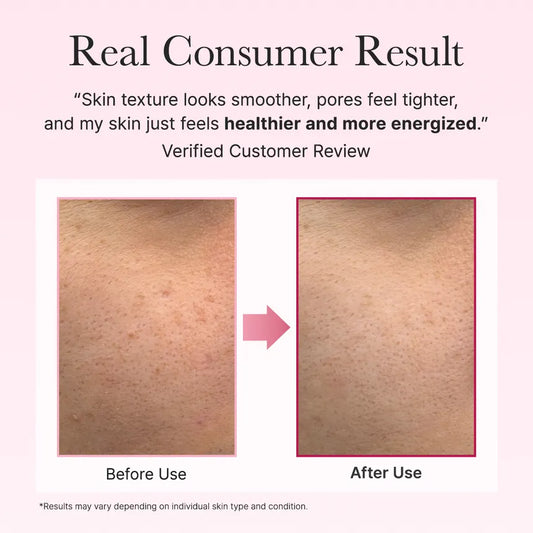 Arencia - PDRN Booster Shot