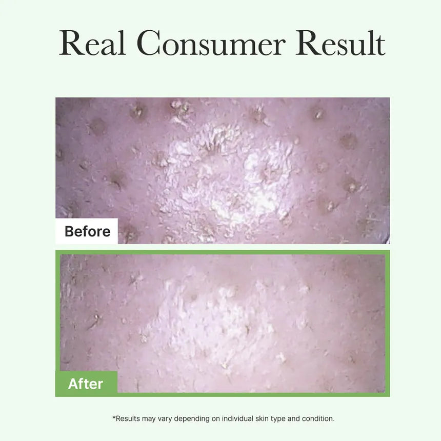 Arencia - Pore Melt Mochi Cleansing Oil